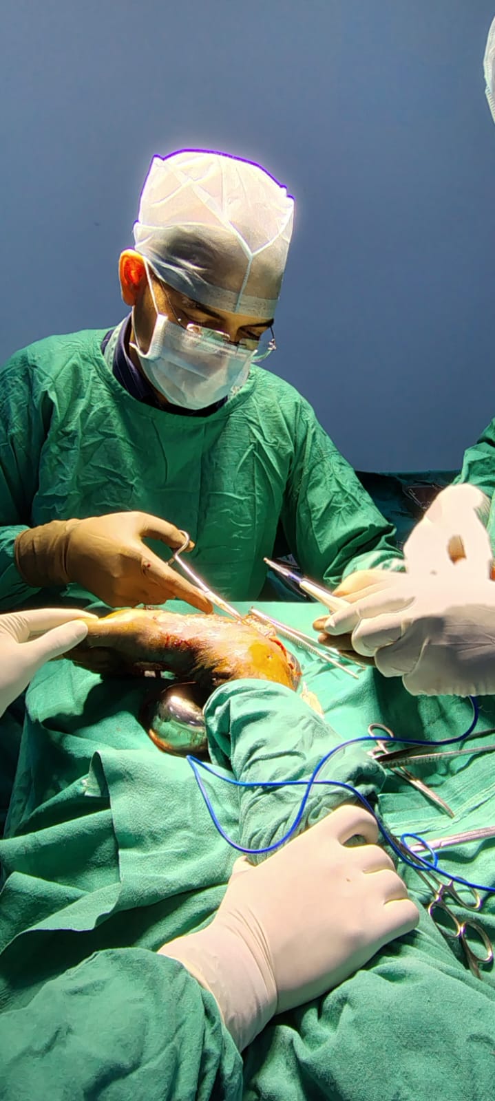 Dr. Sunil Kumar Yadav performing tendon repair surgery on a hand